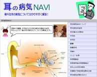 ���̕a�CNAVI