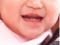 赤ちゃんの虫歯予防