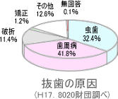 抜歯の原因