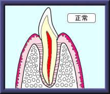 歯周病(歯槽膿漏)の動画