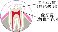 ホワイトニング