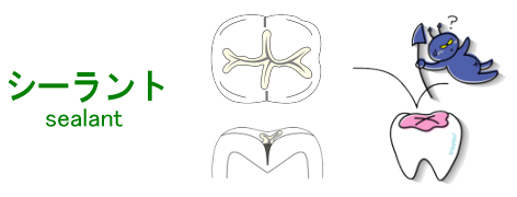 シーラント